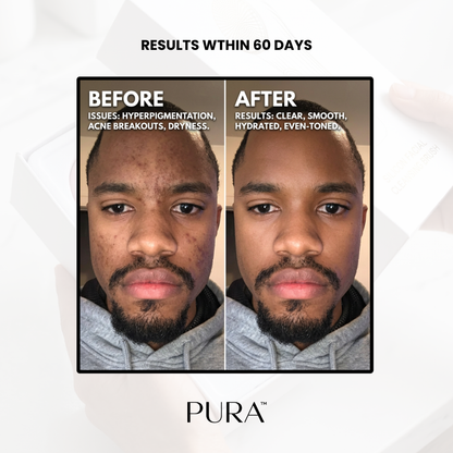 PURA™ - Cleansing Brush